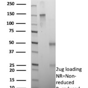 CD137 Antibody in SDS-PAGE