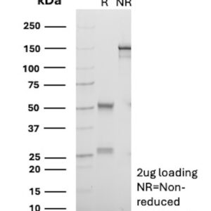 CD18 Antibody in SDS-PAGE