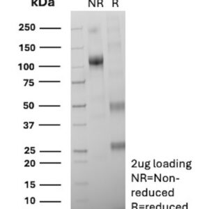 Arginase-1 / ARG1 Antibody in SDS-PAGE
