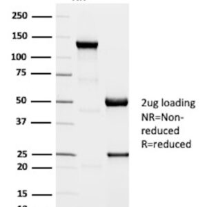 DNA Ligase 1 Antibody in SDS-PAGE