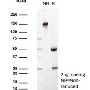 CD146 / MUC18 / MCAM Antibody in SDS-PAGE