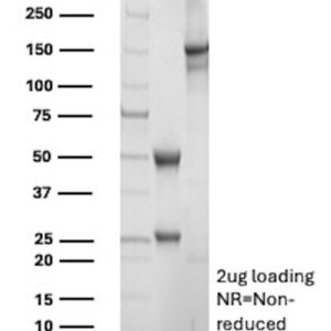 Calcineurin B Antibody in SDS-PAGE