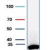 SDHB Antibody in Western Blot (WB)