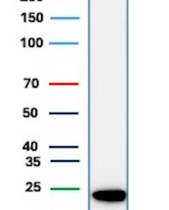 PGP9.5 / UchL1 Antibody in Western Blot (WB)