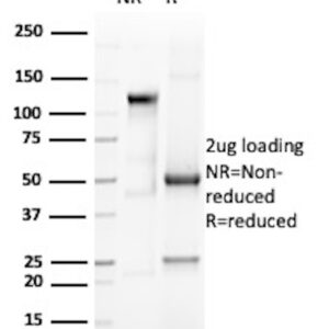 Eosinophil-Peroxidase Antibody in SDS-PAGE