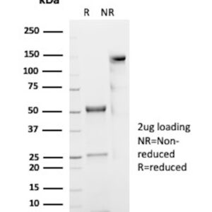 Eosinophil-Peroxidase Antibody in SDS-PAGE