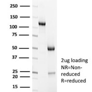 CD7 Antibody in SDS-PAGE