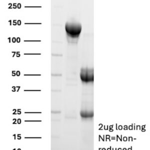 CD8b Antibody in SDS-PAGE