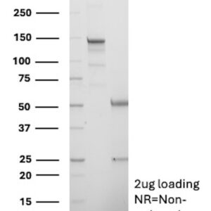 CD38 Antibody in SDS-PAGE