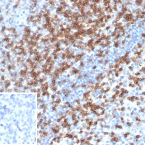 CD2 Antibody in Immunohistochemistry (IHC (P))