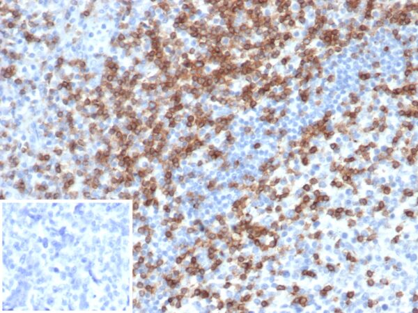 CD2 Antibody in Immunohistochemistry (IHC (P))