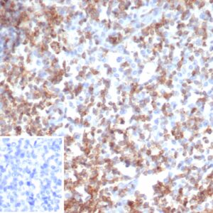 CD2 Antibody in Immunohistochemistry (IHC (P))