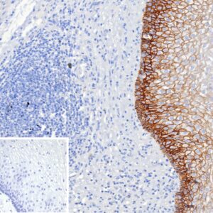 CD44v6 Antibody in Immunohistochemistry (IHC (P))