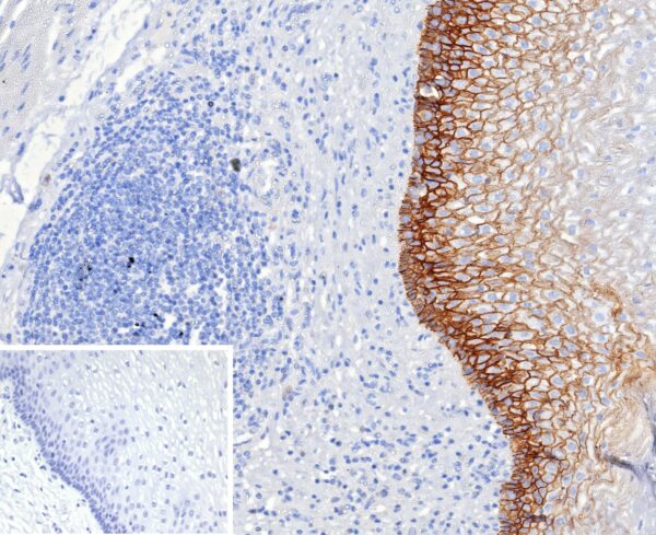 CD44v6 Antibody in Immunohistochemistry (IHC (P))