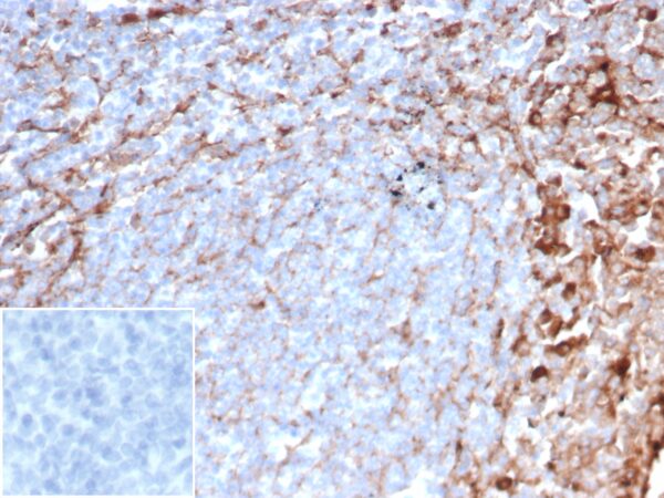 CD63 Antibody in Immunohistochemistry (IHC (P))