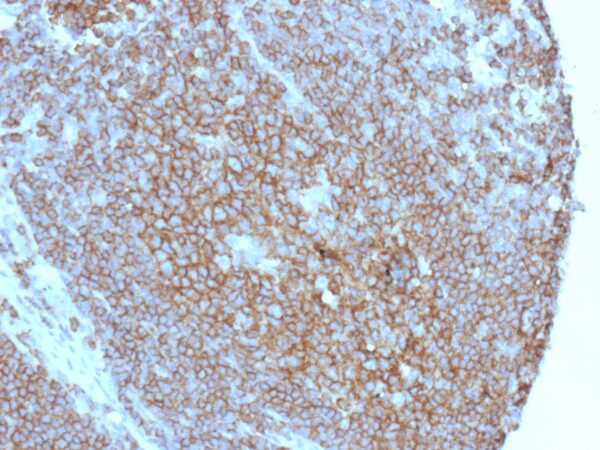 CD86 Antibody in Immunohistochemistry (IHC (P))