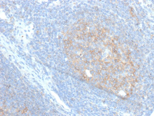 CD86 Antibody in Immunohistochemistry (IHC (P))