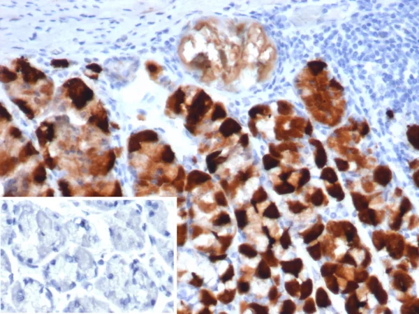 CKBB Antibody in Immunohistochemistry (IHC (P))