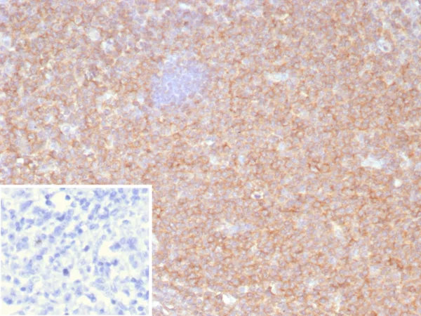 HLA-B Antibody in Immunohistochemistry (IHC (P))