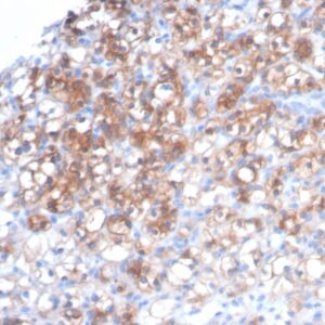 HSP27 Antibody in Immunohistochemistry (IHC (P))