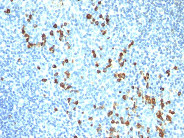 Lambda Light Chain Antibody in Immunohistochemistry (IHC (P))