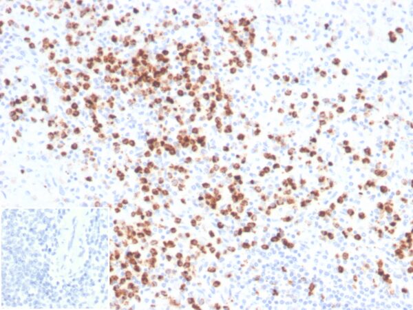 Lysozyme Antibody in Immunohistochemistry (IHC (P))