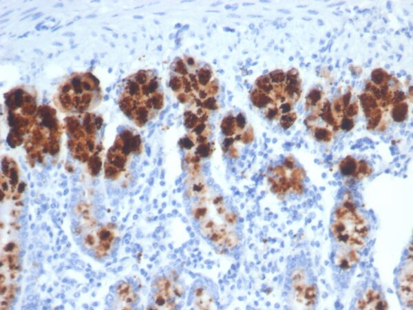 Lysozyme Antibody in Immunohistochemistry (IHC (P))