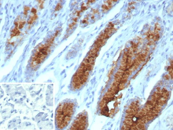 MUC5AC Antibody in Immunohistochemistry (IHC (P))