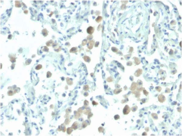 Mesothelin Antibody in Immunohistochemistry (IHC (P))