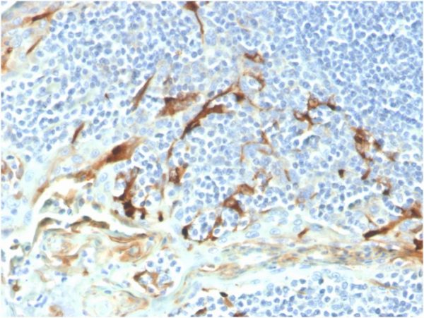 Mesothelin Antibody in Immunohistochemistry (IHC (P))