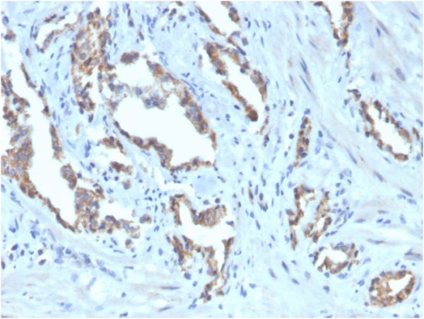 TIGIT Antibody in Immunohistochemistry (IHC (P))