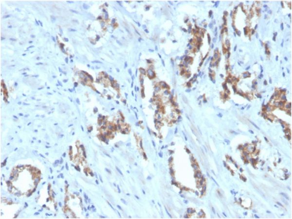 TIGIT Antibody in Immunohistochemistry (IHC (P))