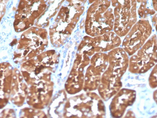 Ferritin, Light Chain (Node-Negative Breast Tumor Prognostic Marker) Antibody