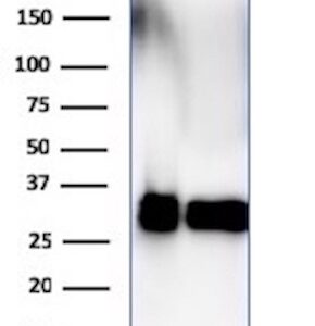 HLA-DRB Antibody in WB