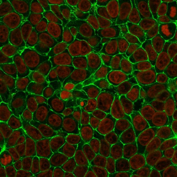 EpCAM Antibody in Immunofluorescence (IF)