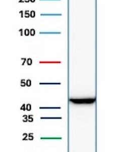 CKBB Antibody in Western Blot (WB)