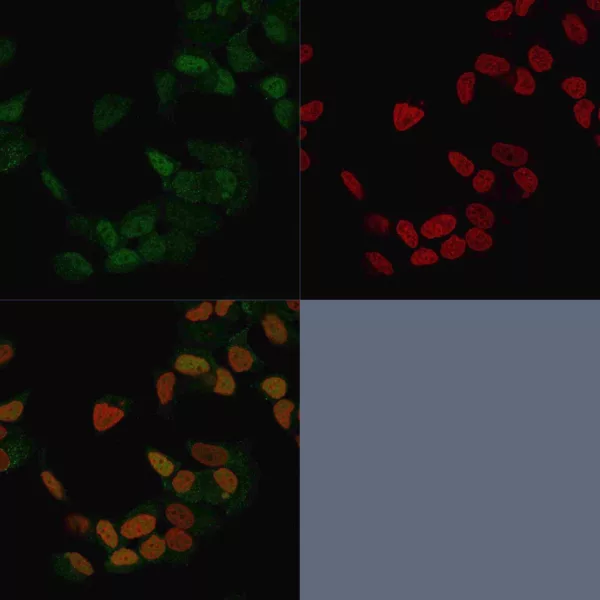 Estrogen Receptor Alpha Antibody in Immunofluorescence (IF).