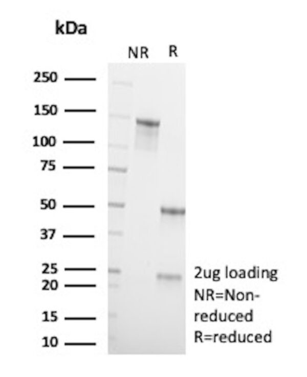 SATB2 Antibody in SDS-PAGE