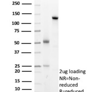 Arginase-1 Antibody in SDS_PAGE