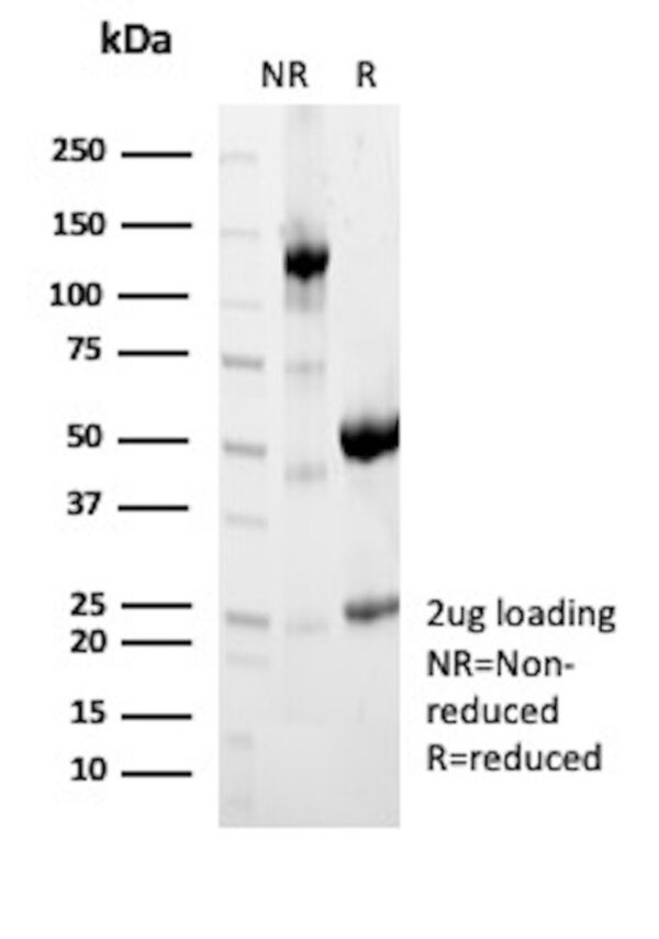 Antibody ACTH is SDS-PAGE