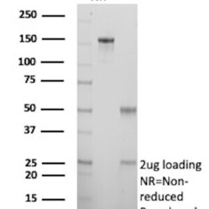 S100A2 Antibody in SDS-PAGE