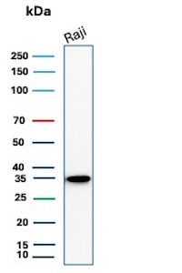 CD20 Antibody in Western Blot (WB)