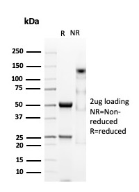 CD38 Antibody in SDS-PAGE