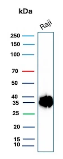 CD74 (B-Cell Marker) (Transcription Regulator) Antibody - Clone CLIP ...