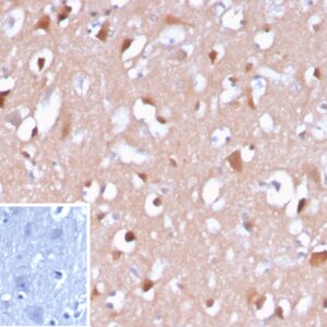 β-Amyloid Antibody in Immunohistochemistry (IHC (P))