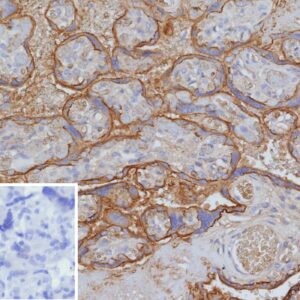 CD147 Antibody in Immunohistochemistry (IHC (P))