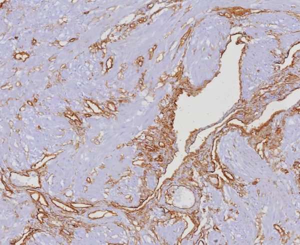 CD34 Antibody in Immunohistochemistry (IHC (P))