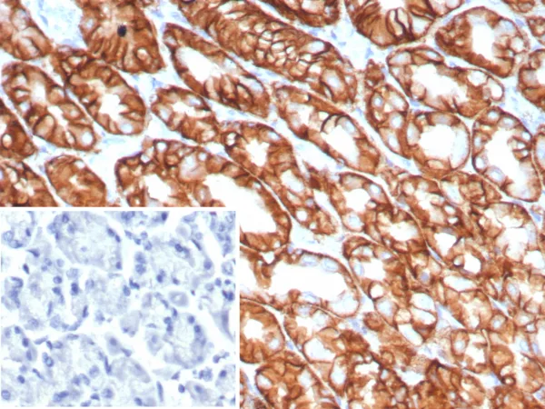 Claudin18.2 Antibody in Immunohistochemistry (IHC (P))