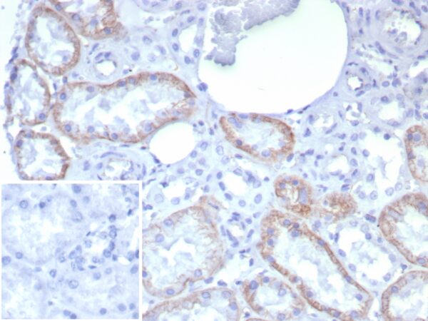 N-Cadherin Antibody in Immunohistochemistry (IHC (P))