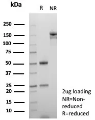 SDS-PAGE Analysis of Purified NUTM1 Recombinant Rabbit Monoclonal Antibody (SNUPN/7363R). Confirmation of Purity and Integrity of Antibody.